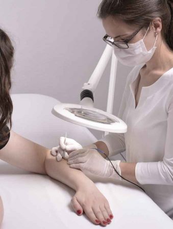 Haarentfernung Berlin, Behandlung Arm