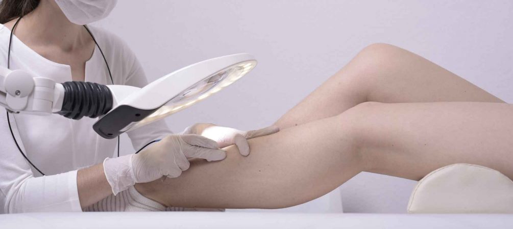 Kaiser Haarentfernung Berlin, Behandlung Bein